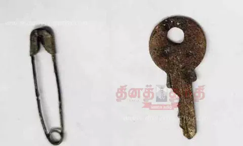 சாவி, ஊக்குகளை விழுங்கிய குழந்தைகள் - ஆபரேஷன் இன்றி அகற்றி அரசு டாக்டர்கள் சாதனை
