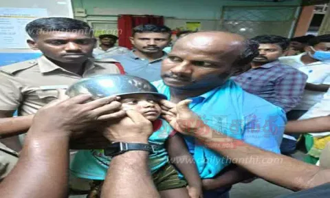 சிறுவன் தலையில் மாட்டிக் கொண்ட சில்வர் பாத்திரம்; தீயணைப்பு படையினர் லாவகமாக அகற்றினர்