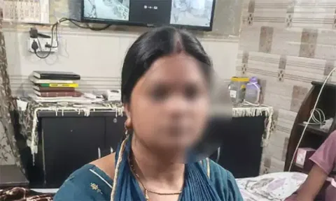 டெல்லி: நாயை ஏவி விட்டு பெண்ணை கடிக்க வைத்த நபர்