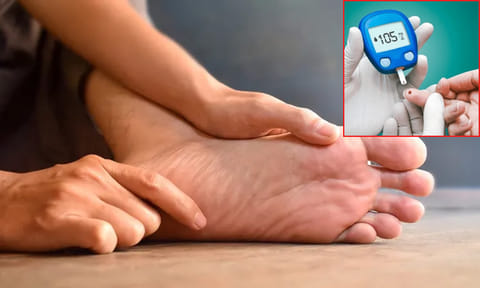 சர்க்கரை நோயாளிகளுக்கு கால் பாதங்களில் எரிச்சல் ஏற்படுவது ஏன்?