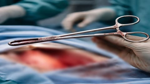 Representative Image for surgical foreceps