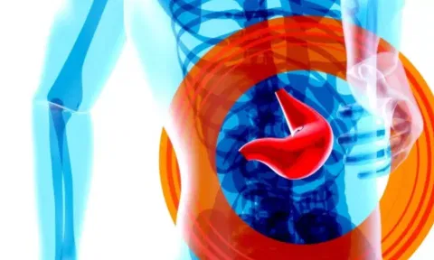 liver disease