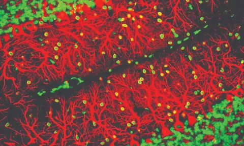 The researchers have only a dim notion of what the newly discovered cells do. 