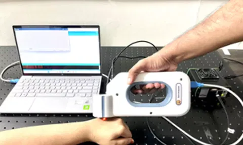 Portable analyser to diagnose skin conditions 