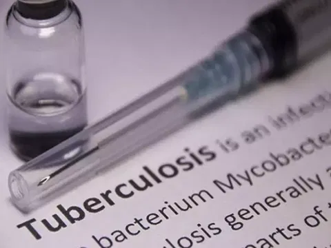One stop center for TB can assist in streamlining diagnosis and treatment