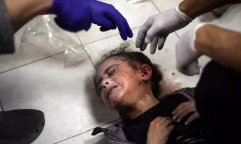 A Palestinian child wounded during the Israeli bombardment of the Gaza Strip receives treatment at the Nasser hospital in Khan Younis. (AP)