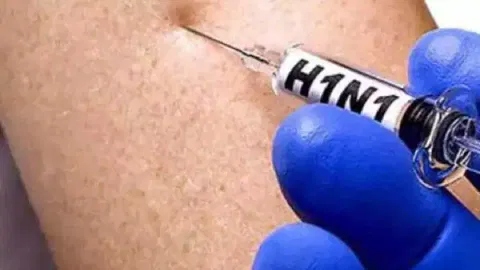 H1N1 influenza