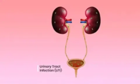 DT Health: Managing urinary problems during soaring summer heat