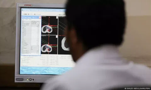 Lung Scan visual