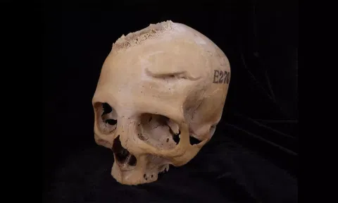 Skull and Mandible 236, dating from between 2687 and 2345 BCE (Photo/IANS)