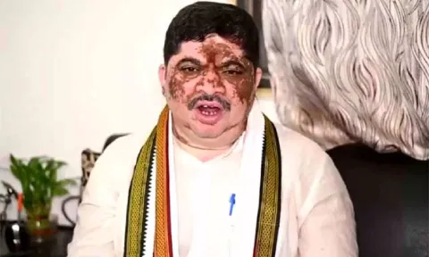 Telangana Minister Ponnam Prabhakar 