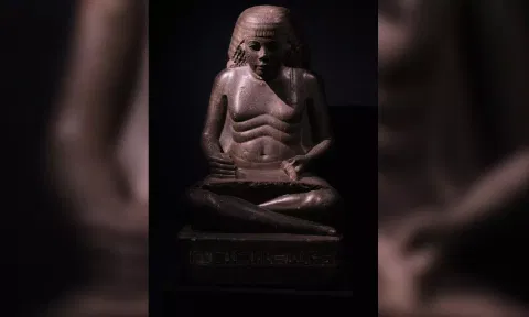 Ancient Scribes Got Ergonomic Injuries, Too