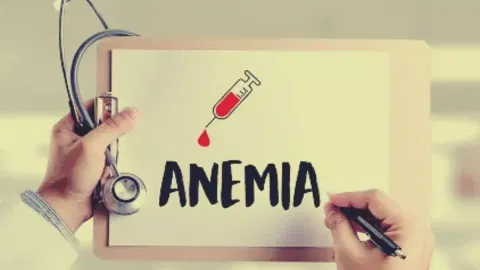 Representative anemia image 