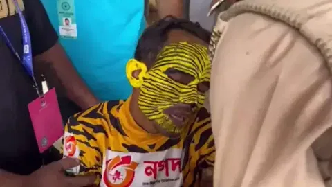 Robi after falling ill 