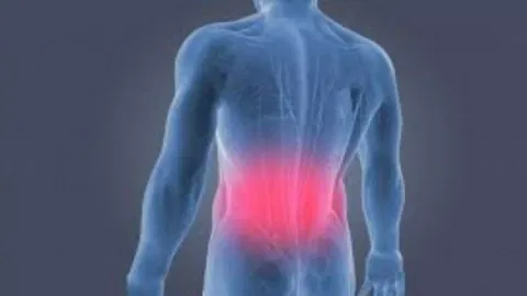Representative backpain image 
