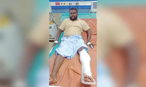  Mohammed Thowfiq suffered a gunshot wound below his left knee on Wednesday