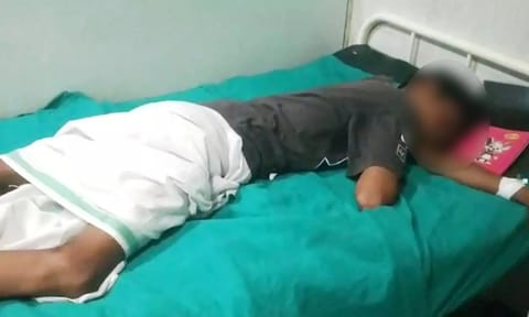 Chennai student injured by acid 