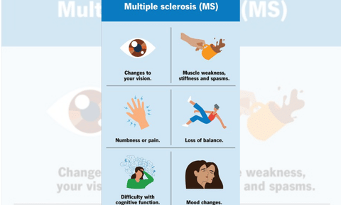 Multiple sclerosis (IANS)
