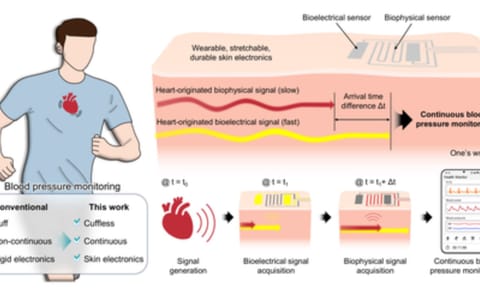 New bandage-like wearable monitor (IANS)