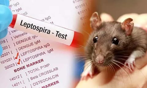 Tirunelveli college shut temporarily after 7 students show rat fever signs