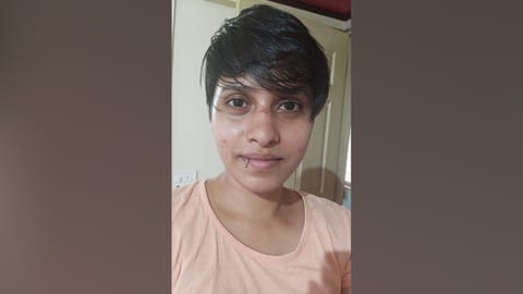 Shraddha Walker with bruises on her face