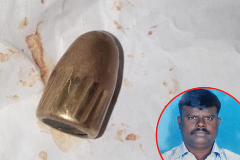 Rajendran (inset) and the bullet removed from his toe