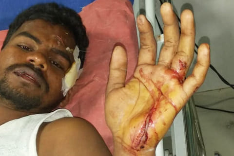 Raj was treated at Government Stanley Hospital