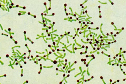 Solutions to curb Diphtheria infection