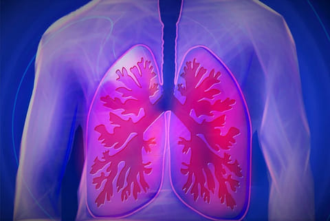 Osteoporosis treatment may also protect against pneumonia