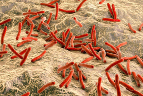 Consultancy Corner: Early detection of leprosy can save nerve cells