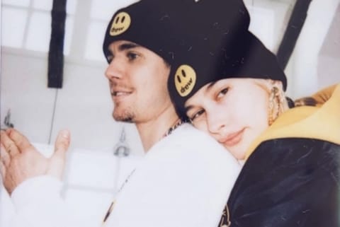 Hailey Bieber had to undergo therapy to cope with negative attention