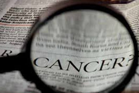 Ovarian Cancer (File photo)