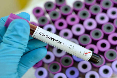 Latest Covid testing kit 'SENSIT' exhibits 86-100 percent specificity