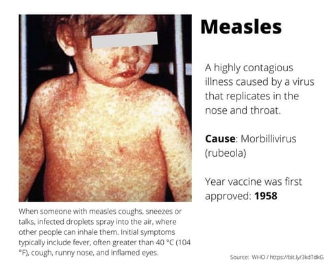 600+ cases: US measles epidemic grows with South Carolina outbreak
