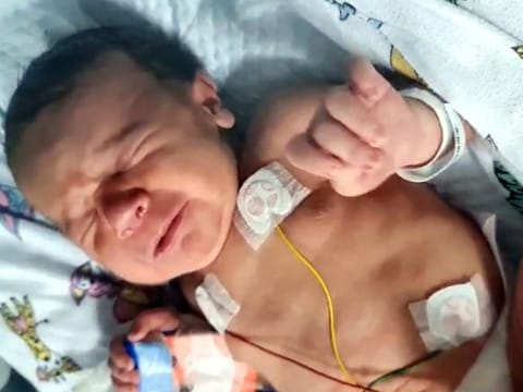 Hero aunt saves five-month-old baby in UAE’s youngest liver transplant