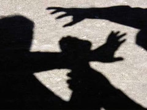 Father and son assault man, causing 10% leg disability; court orders Dh30,000 compensation