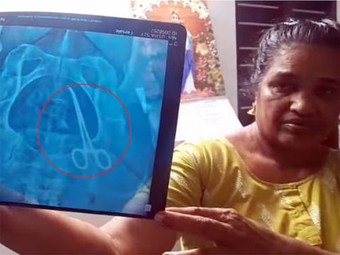 A case of suspected medical negligence has come to light after a surgical scissor was discovered inside the abdomen of a 51 year-old woman
