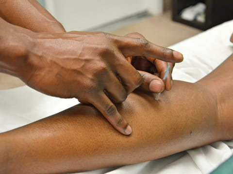 Picture for illustrative purposes: acupuncture