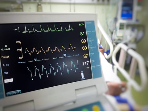 An ECG reading. Picture for illustrative purposes only.
