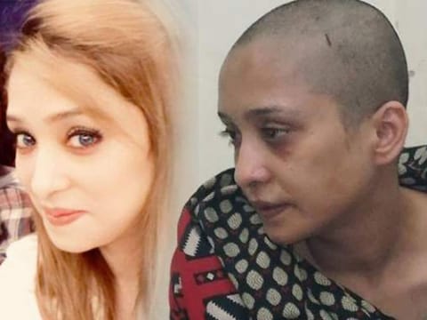 Wife posts before and after shots of her face, pleading for justice