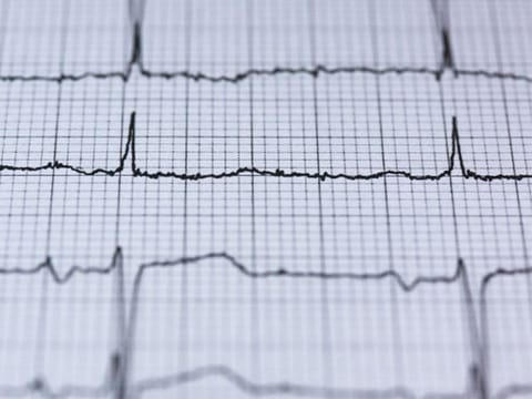 A patient at Burjeel Hospital in Abu Dhabi underwent a complex surgery to fix his heart without opening up his chest.