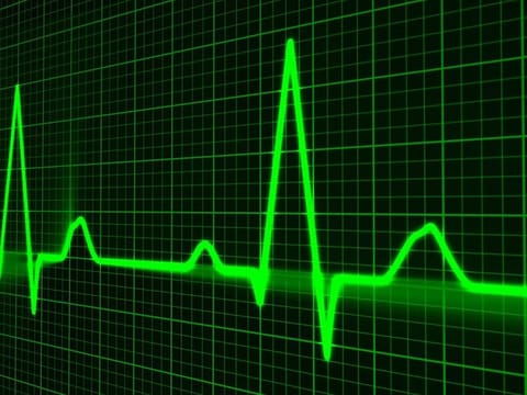 Photo of cardiac monitor display for illustrative purposes only