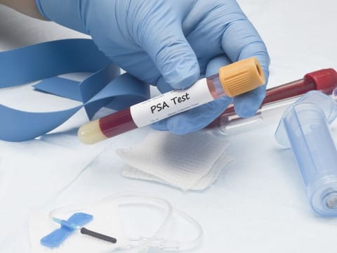 November ends but prostate cancer concerns remain