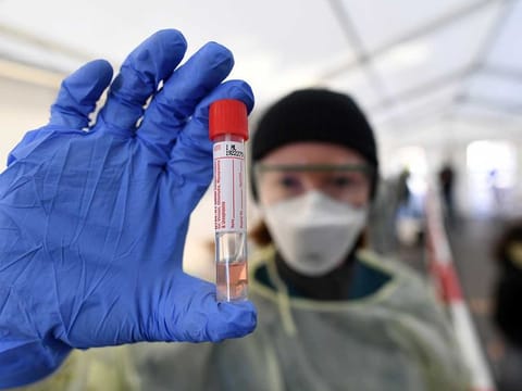 A medical employee presents a smear taken at a special corona test centre for public service employees such as police officers, nurses and firefighters during a media presentation as the spread of the coronavirus disease (COVID-19) continues, in Munich, Germany, March 23, 2020.