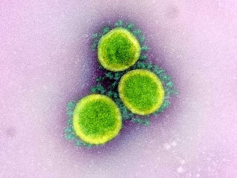 A transmission electron micrograph of SARS-CoV-2 virus particles, also known as novel coronavirus, the virus that causes COVID-19, isolated from a patient.
