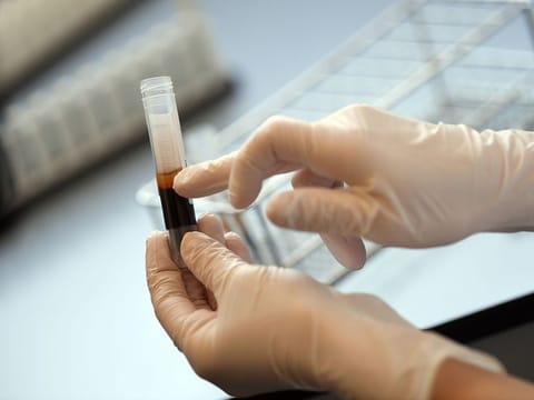 Picture for illustrative purposes: Researcher checks plasma samples