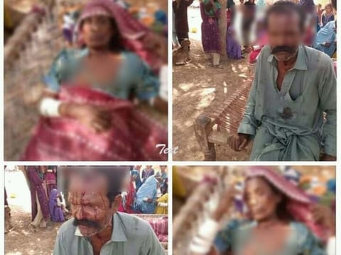 Warning: Graphic images. Gulab and his wife attacked in Rahim Yar Khan, Pakistan.