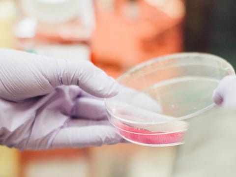 Bacteria to avoid when pregnant
