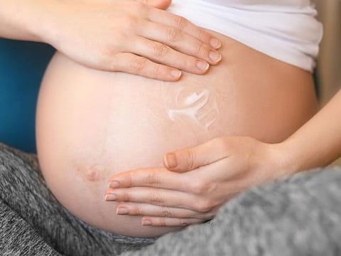 How to avoid stretch marks in pregnancy
