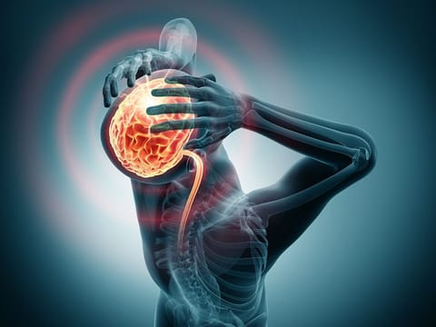 iStock